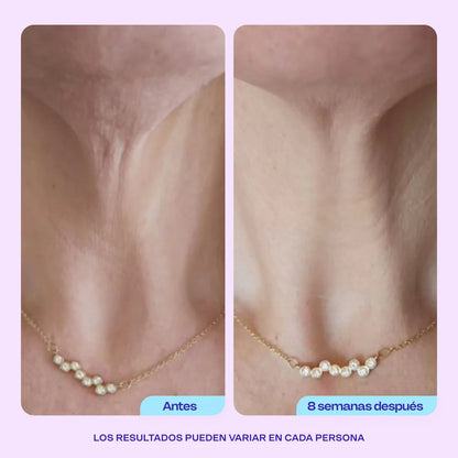Crema Gopure - Reafirma tu cuello Hoy Mismo!