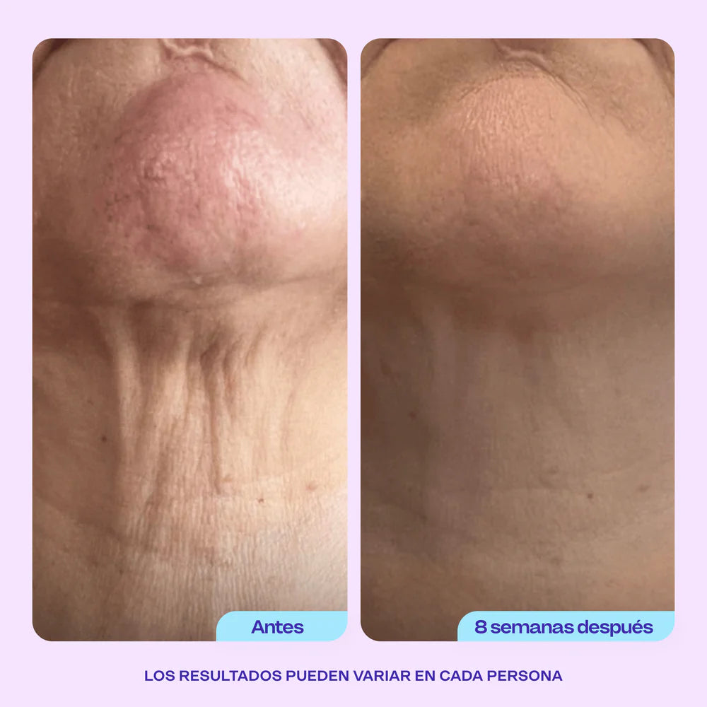 Crema Gopure - Reafirma tu cuello Hoy Mismo!
