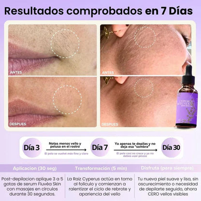 Lunéa™ - Vello fino y menos visible con Raiz de Cyperus Rotundus